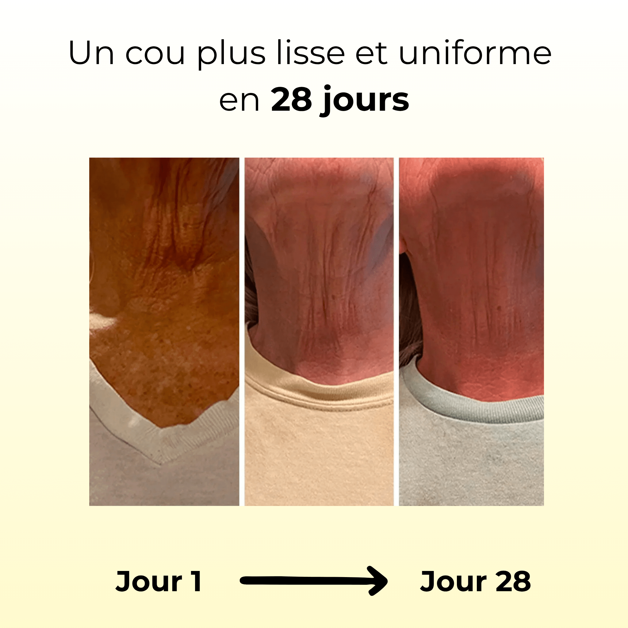 Crème Lifting Ciblé – Cou & Contours